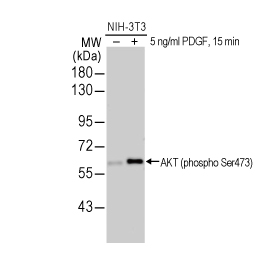 AKT (phospho Ser473) antibody (GTX128414)